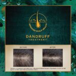 Indulekha Svetakutaja Dandruff Hair Oil 50ml - Image 2