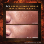 Indulekha Ayurvedic Soap 100g - Image 4