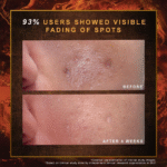 Indulekha Ayurvedic Soap 100g - Image 5