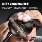 Head shoulder Deep Cleanse Charcoal Shampoo 72ml - Image 4