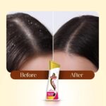 Meera Anti Dandruff Shampoo 180ml Small onion Fenugreek - Image 5
