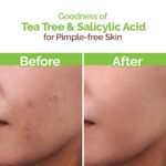 Mamaearth Oil Control With Tea tree Neem For Normal To Only Skin Face Wash 100ml - Image 5
